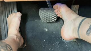 Foot arthritis, rough riding HD