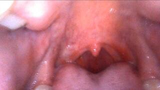 Giantess Kimmy Mouth Endoscope