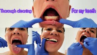 Thorough cleaning of my teeth - Dentist Examination - Mouth Fetish - Tooth Fetish