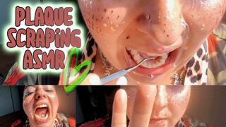 ASMR Dental Fun Taboo: Plaque Scraping, ASMR Teeth Cleaning in Sunlight | Natural Sounds + Up-Close Plaque Removal (BBW Freckled Goddess)