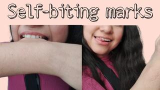Self-biting marks: forearm, hand and fingers
