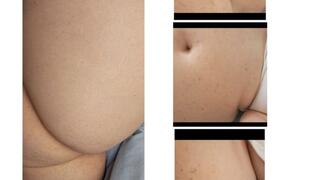 New Belly Noises Plus SNEEZING AND FARTING