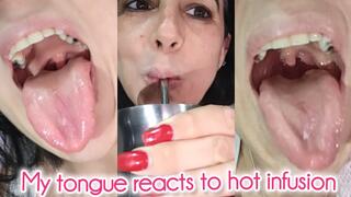 My tongue reacts to hot infusion!