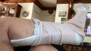 How I Broke My Ankle (2019): Sophia Sylvan Leg Cast