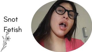 I'm plagued by stinky snot