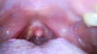 First Time With An Endoscope