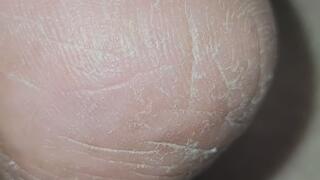 Dry Giantess soles under cover