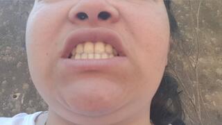 My disgusting yellow teeth shine in the day