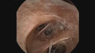 Mouth Exploration Trip