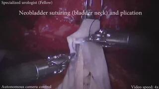 Tiny robot arms touching my guts