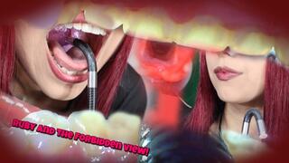 Ruby and the forbidden view endoscope