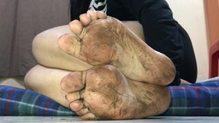 Dirty feet with lotion