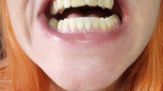 Morning Before Brushing My Rotten Teeth