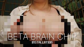 BETA BRAIN CHIP INSTALLATION