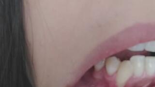 Look closely inside my mouth