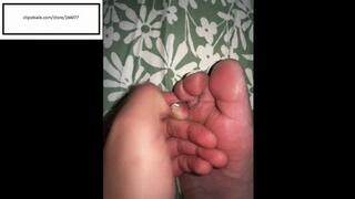 Itchymimis itchy feet after work then next am