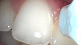 POV Fantasy: You’re the Floss in Her 20-Year-Old Mouth