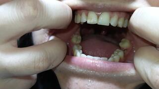 Big mouth salivating