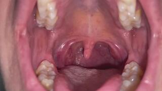 Long big Uvula 2