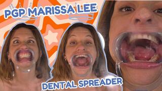 Plexiglass Princess Marissa Lee Dental Spreader