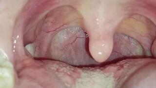 “Intimate Uvula Detail”