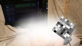 Jamie's Heart Attack (Part 2)