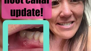 Just brushing my teeth and discussing my pending ROOT CANAL on Tooth #46 (oct 6 2025)