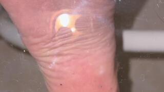 Under Glass Dirty Feet SQUASH!