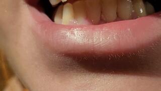 Showing my rotten teeth and tongue before brushing - progress of the tooth I lost