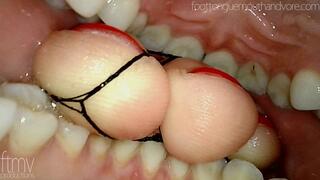 Foot and Tongue In Mouth (Endoscope and Regular)