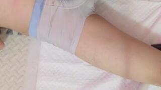 Nurse and Patient Treatment: Phase two