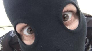 I scratch my legs and butt a