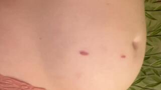 Belly Button Bug by DreamyBellyASMR