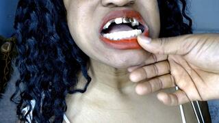 Unexpected Sparks at the Dentist