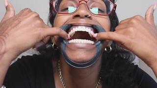 Dental Retractor Mouth Tour