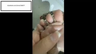 Di888 itchy feet inspection and SCRATCH