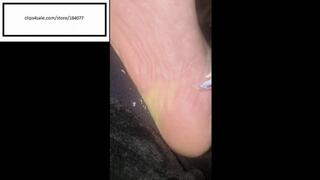 Velvet just picking away and itching feet