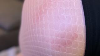 Open Wide: The Patient Who Couldn't Stop Biting, Mouth Fetish, Biting Fetish, Finger Fetish