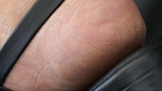 Foot and sandal fetish admiration, feet close-up skin details, heels, arched sole and toes.