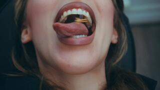 Tiny Dentist Is Eaten By His Patient - Imilia Audley