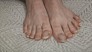 A Detailed Investigation of My Neglected Feet