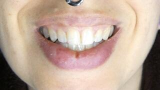 Open Mouth Vape Exhale Lots of Smoke and Teeth!