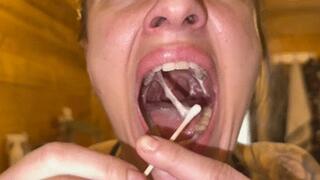 Throat rot, angina pectoris, crypt cleansing