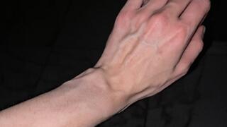 Plumped veins after the shower