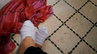 SEVERELY RUINED FEET