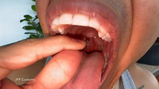 Abhi Swallows Tiny Loser- MKV