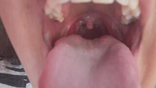 Full View of My Throat: Tongue Out and Vault Visible