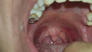 Exploring My Throat.