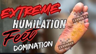 Dry Feet Domination Extreme Flaky Skin Humiliation