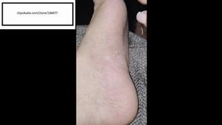 Velvet itches and picks away at her foot